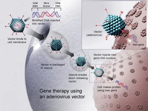 Gene Therapy: Revolutionizing Genetic Disease Treatment